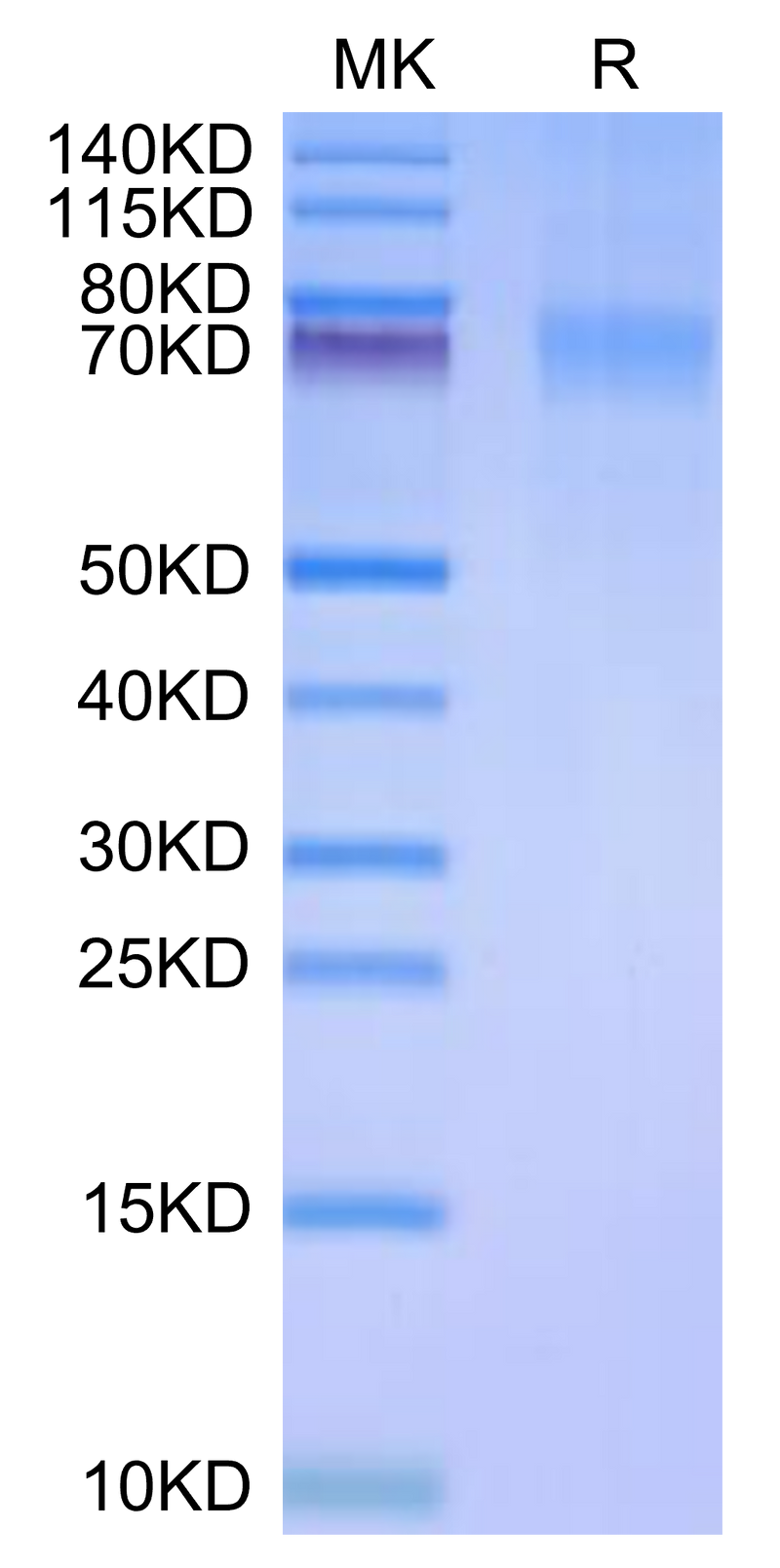 Human Siglec-10 (R119A) on Tris-Bis PAGE under reduced condition. The purity is greater than 95%.Recombinant Human Siglec-10 (R119A) Protein, Active