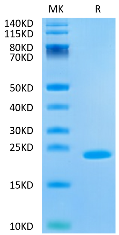 Human IL-37b on Tris-Bis PAGE under reduced condition. The purity is greater than 95%.Recombinant Human IL-37b Protein