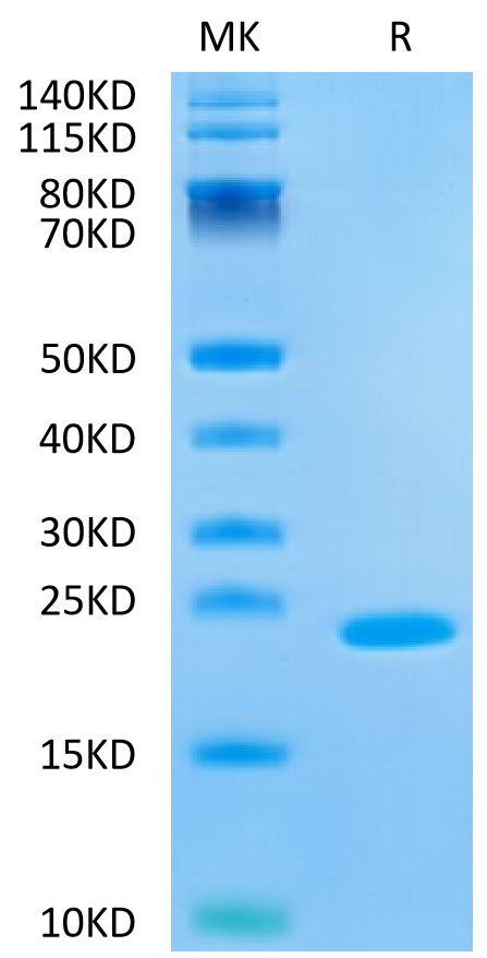 Human IL-37b on Tris-Bis PAGE under reduced condition. The purity is greater than 95%.Recombinant Human IL-37b Protein