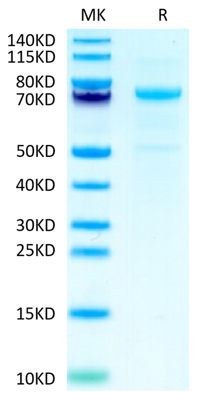 Cynomolgus CDH3 on Tris-Bis PAGE under reduced condition. The purity is greater than 95%.Recombinant Cynomolgus CDH3/Cadherin 3 Protein, Active