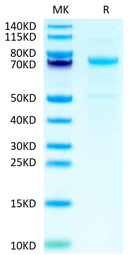 Cynomolgus CDH3 on Tris-Bis PAGE under reduced condition. The purity is greater than 95%.Recombinant Cynomolgus CDH3/Cadherin 3 Protein, Active