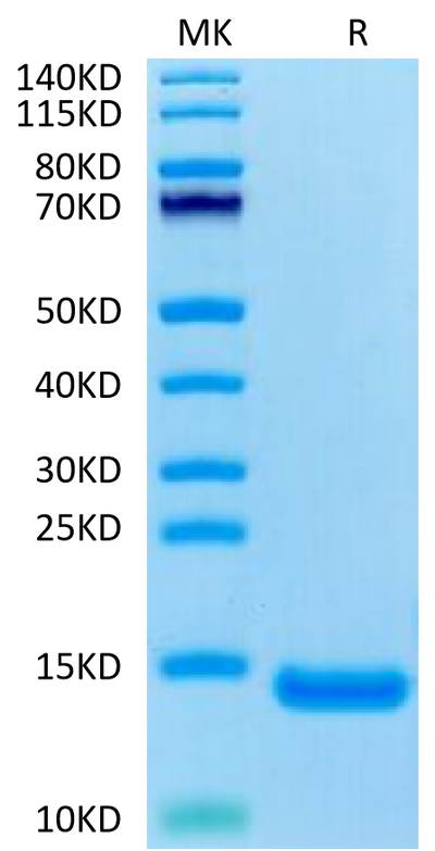 Human CCL11 on Tris-Bis PAGE under reduced condition. The purity is greater than 95%.Recombinant Human CCL11 Protein