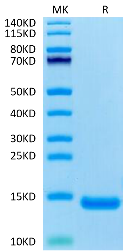 Human CCL11 on Tris-Bis PAGE under reduced condition. The purity is greater than 95%.Recombinant Human CCL11 Protein