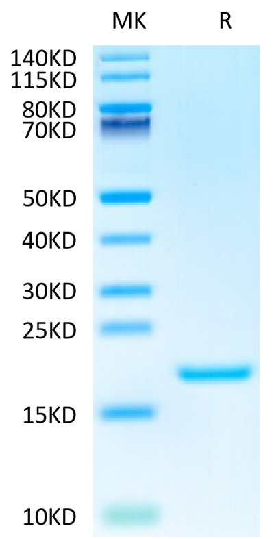 Human IL-3 on Tris-Bis PAGE under reduced condition. The purity is greater than 95%.Recombinant Human IL-3 Protein, Active