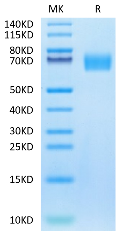 Biotinylated Human EGFRVIII on Tris-Bis PAGE under reduced condition. The purity is greater than 95%.Biotinylated Human EGFRVIII Protein, Active