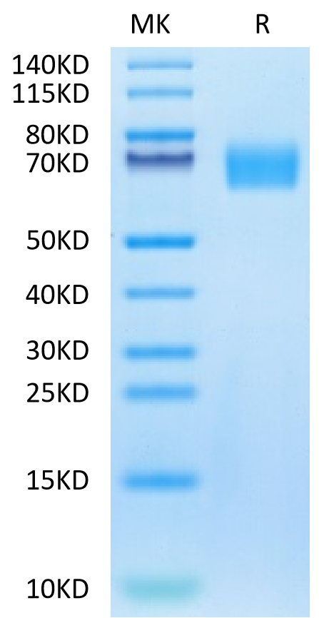 Biotinylated Human EGFRVIII on Tris-Bis PAGE under reduced condition. The purity is greater than 95%.Biotinylated Human EGFRVIII Protein, Active