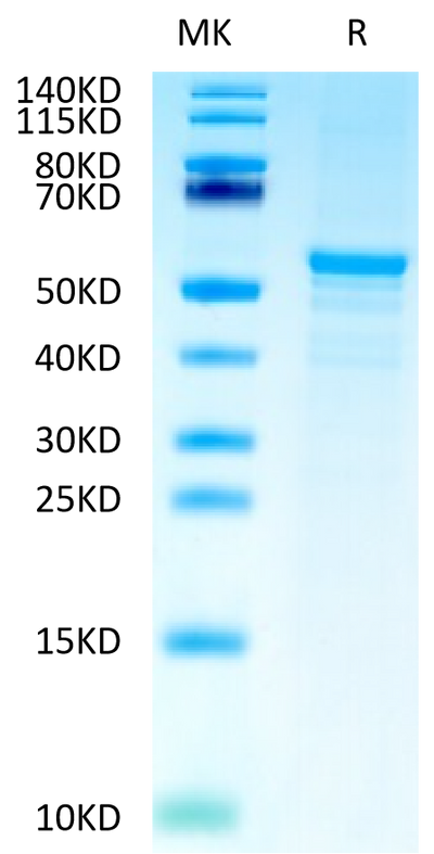 Human CKAP4 on Tris-Bis PAGE under reduced condition. The purity is greater than 90%.Recombinant Human CKAP4 Protein