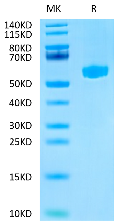 Mouse Hyaluronidase 2 on Tris-Bis PAGE under reduced condition. The purity is greater than 95%.Recombinant Mouse Hyaluronidase 2/HYAL2 Protein
