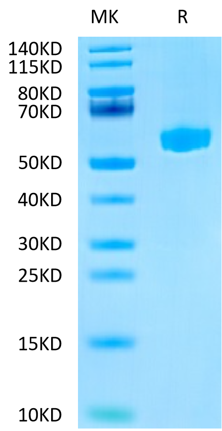 Mouse Hyaluronidase 2 on Tris-Bis PAGE under reduced condition. The purity is greater than 95%.Recombinant Mouse Hyaluronidase 2/HYAL2 Protein