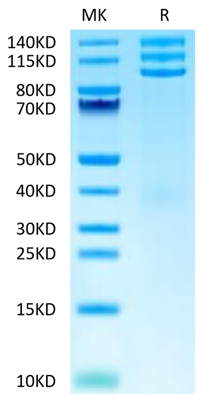 Cynomolgus ITGAV&ITGB3 on Tris-Bis PAGE under reduced condition. The purity is greater than 95%.Recombinant Cynomolgus Integrin alpha V beta 3 (ITGAV&ITGB3) Heterodimer Protein, Active