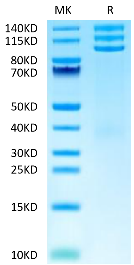 Cynomolgus ITGAV&ITGB3 on Tris-Bis PAGE under reduced condition. The purity is greater than 95%.Recombinant Cynomolgus Integrin alpha V beta 3 (ITGAV&ITGB3) Heterodimer Protein, Active