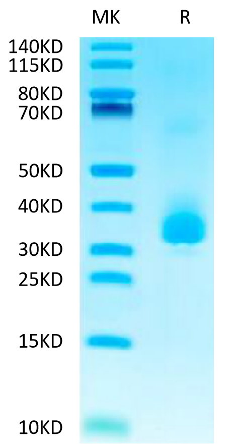 Biotinylated Human ANGPTL3 on Tris-Bis PAGE under reduced conditions. The purity is greater than 95%.Biotinylated Human ANGPTL3/Angiopoietin-like 3 Protein, Active