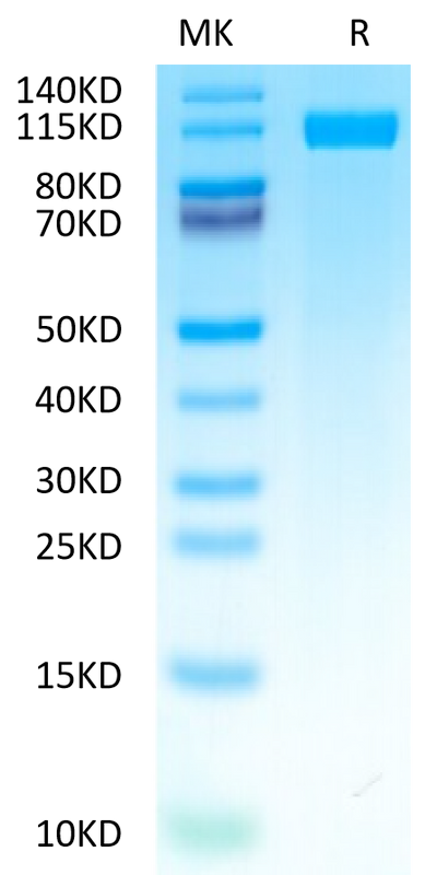 Human CD117 on Tris-Bis PAGE under reduced condition. The purity is greater than 95%.Recombinant Human CD117 Protein, Active