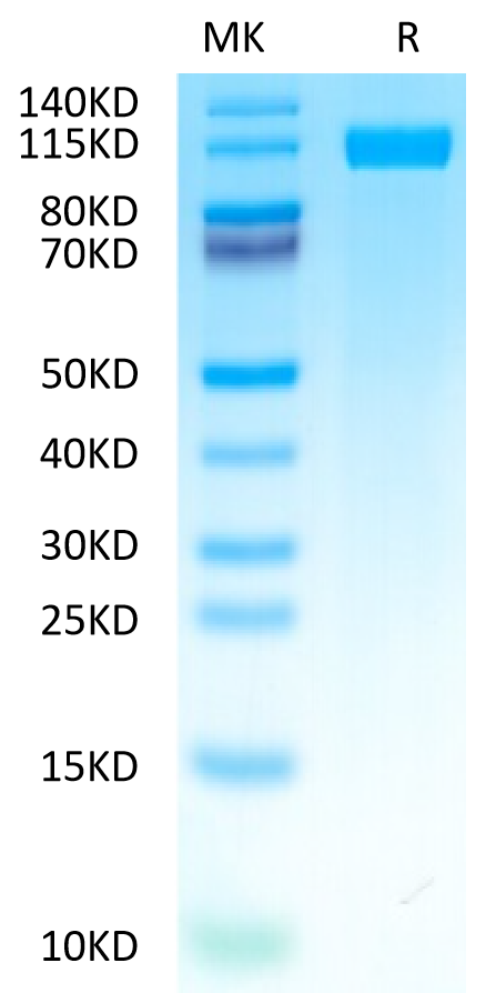 Human CD117 on Tris-Bis PAGE under reduced condition. The purity is greater than 95%.Recombinant Human CD117 Protein, Active