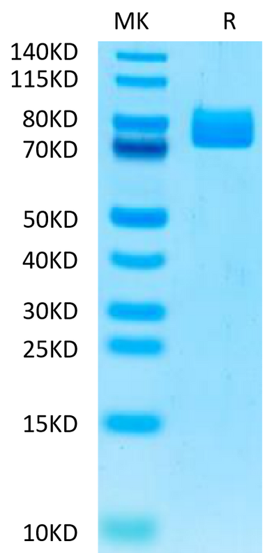 Human MADCAM1 on Tris-Bis PAGE under reduced condition. The purity is greater than 95%.Recombinant Human MADCAM1 Protein, Active