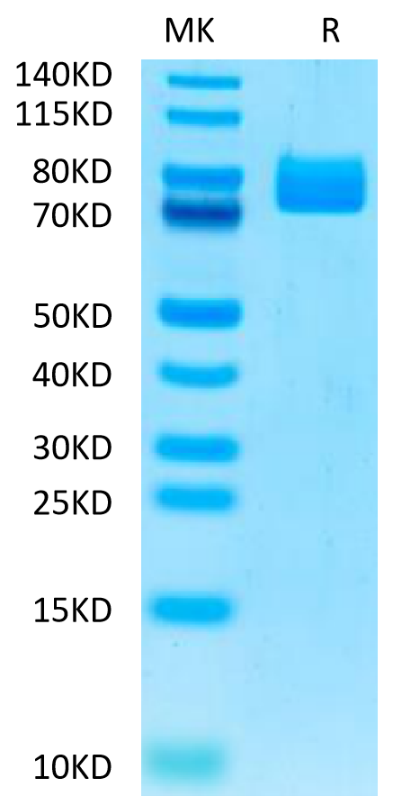 Human MADCAM1 on Tris-Bis PAGE under reduced condition. The purity is greater than 95%.Recombinant Human MADCAM1 Protein, Active