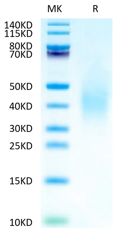 Human FGFR2 beta (IIIb) Domain on Tris-Bis PAGE under reduced condition. The purity is greater than 95%.Recombinant Human FGFR2 beta (IIIb) Domain Protein, Active
