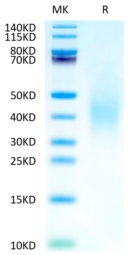 Human FGFR2 beta (IIIb) Domain on Tris-Bis PAGE under reduced condition. The purity is greater than 95%.Recombinant Human FGFR2 beta (IIIb) Domain Protein, Active