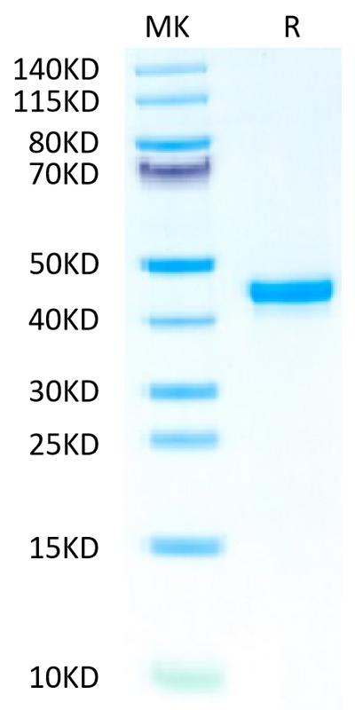 Human FGL2 on Tris-Bis PAGE under reduced condition. The purity is greater than 95%.Recombinant Human FGL2 Protein, Active