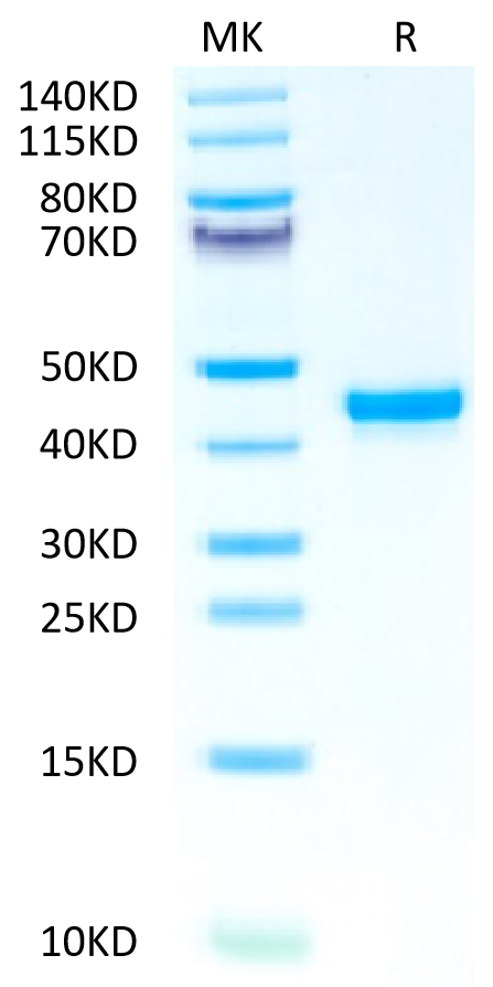 Human FGL2 on Tris-Bis PAGE under reduced condition. The purity is greater than 95%.Recombinant Human FGL2 Protein, Active