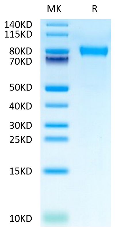 Mouse CD117 on Tris-Bis PAGE under reduced condition. The purity is greater than 95%.Recombinant Mouse CD117 Protein, Active