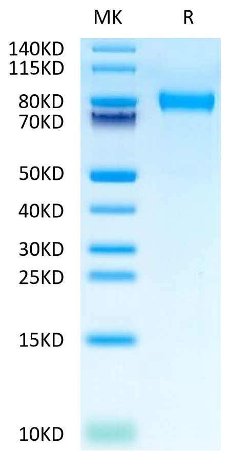 Mouse CD117 on Tris-Bis PAGE under reduced condition. The purity is greater than 95%.Recombinant Mouse CD117 Protein, Active