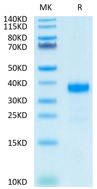 Human ANGPTL7 on Tris-Bis PAGE under reduced condition. The purity is greater than 90%.Recombinant Human ANGPTL7/CDT6 Protein