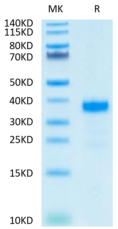 Human ANGPTL7 on Tris-Bis PAGE under reduced condition. The purity is greater than 90%.Recombinant Human ANGPTL7/CDT6 Protein