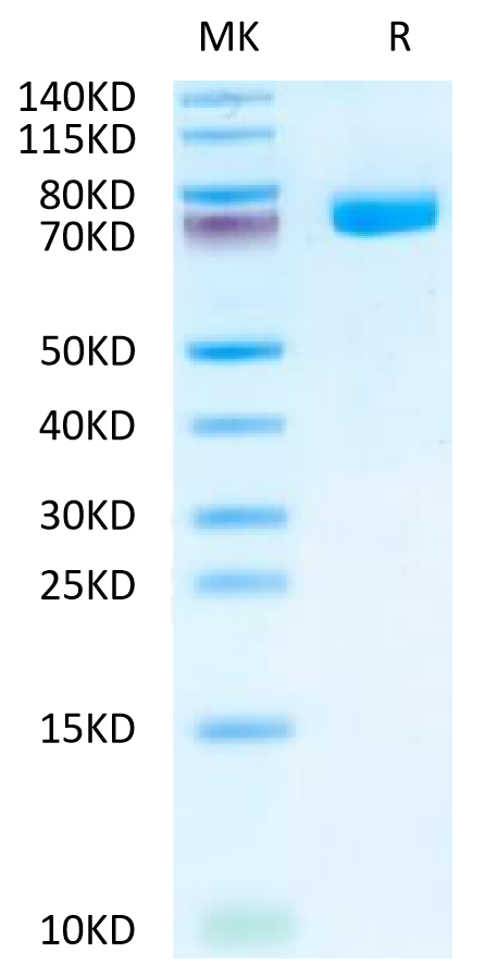 Biotinylated Human Siglec-10 on Tris-Bis PAGE under reduced condition. The purity is greater than 95%.Biotinylated Human Siglec-10 Protein, Active