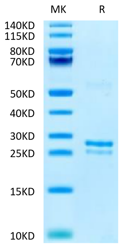Canine TK1 on Tris-Bis PAGE under reduced condition. The purity is greater than 95%.Recombinant Canine TK1 Potein