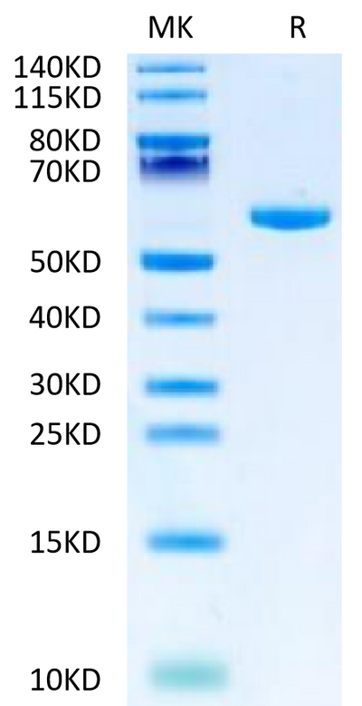 Human LY6G6F on Tris-Bis PAGE under reduced condition. The purity is greater than 95%.Recombinant Human LY6G6F Protein