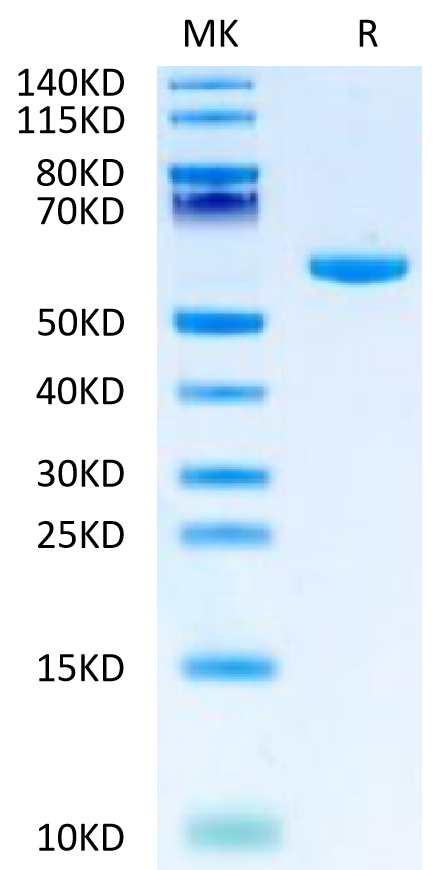 Human LY6G6F on Tris-Bis PAGE under reduced condition. The purity is greater than 95%.Recombinant Human LY6G6F Protein