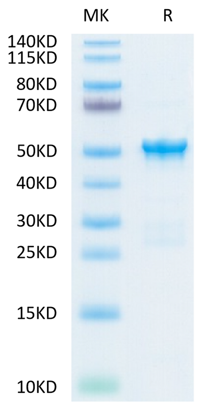 SARS-COV-2 Nucleocapsid on Tris-Bis PAGE under reduced condition. The purity is greater than 95%.Recombinant SARS-COV-2 Nucleocapsid Protein