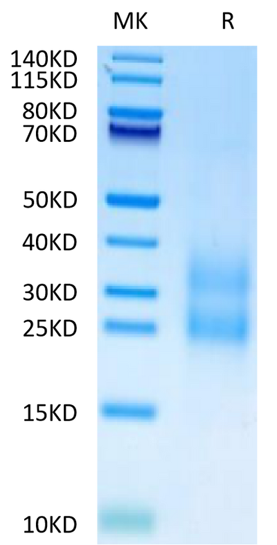 Cynomolgus CCL24 on Tris-Bis PAGE under reduced condition. The purity is greater than 90%.Recombinant Cynomolgus CCL24 Protein, Active