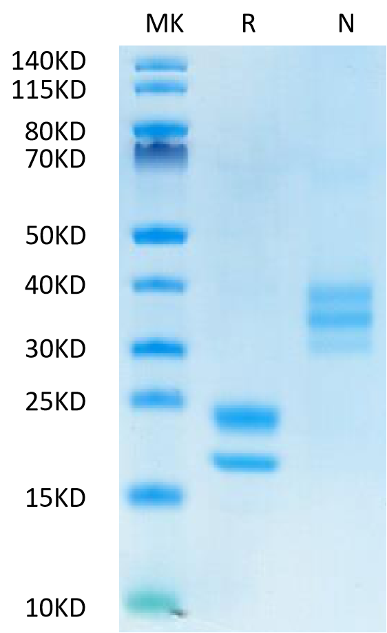 Human VEGF121 on Tris-Bis PAGE under reduced (R) condition and Non reducing (N) condition. The purity is greater than 95%.Recombinant Human VEGF121 Protein, Active
