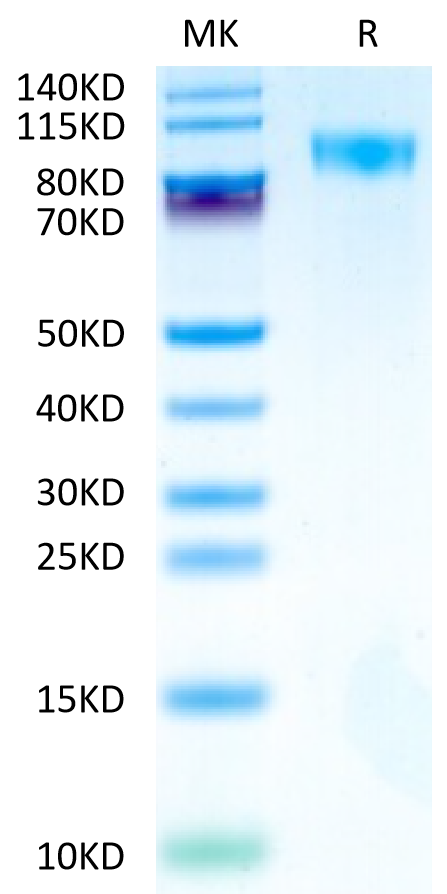 Cynomolgus/Rhesus macaque CD117 on Tris-Bis PAGE under reduced condition. The purity is greater than 95%.Recombinant Cynomolgus/Rhesus macaque CD117 Protein, Active