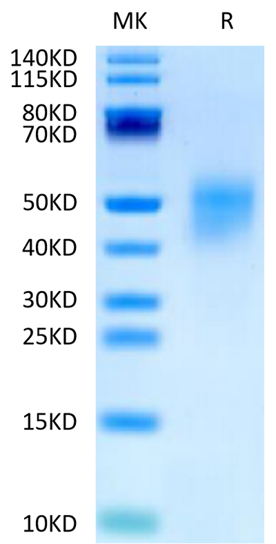 Human FGFR4 beta on Tris-Bis PAGE under reduced condition. The purity is greater than 95%.Recombinant Human FGFR4 beta Protein