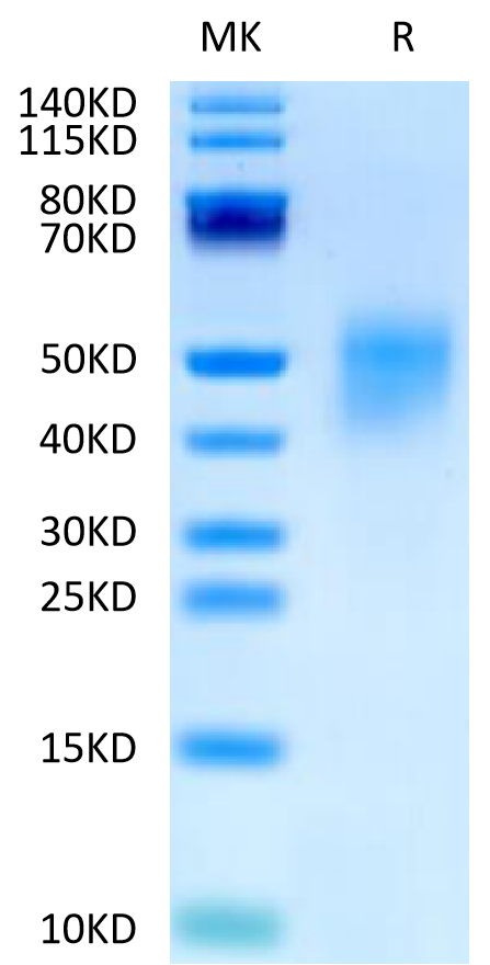 Human FGFR4 beta on Tris-Bis PAGE under reduced condition. The purity is greater than 95%.Recombinant Human FGFR4 beta Protein