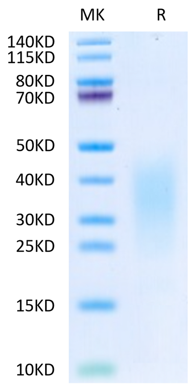 Human IL-13 on Tris-Bis PAGE under reduced condition. The purity is greater than 95%.Recombinant Human IL-13 Protein, Active