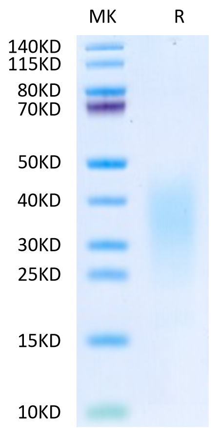 Human IL-13 on Tris-Bis PAGE under reduced condition. The purity is greater than 95%.Recombinant Human IL-13 Protein, Active