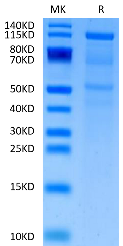 Human CDH6 on Tris-Bis PAGE under reduced condition. The purity is greater than 90%.Recombinant Human CDH6/Cadherin-6 Protein