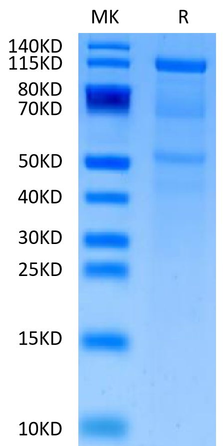 Human CDH6 on Tris-Bis PAGE under reduced condition. The purity is greater than 90%.Recombinant Human CDH6/Cadherin-6 Protein