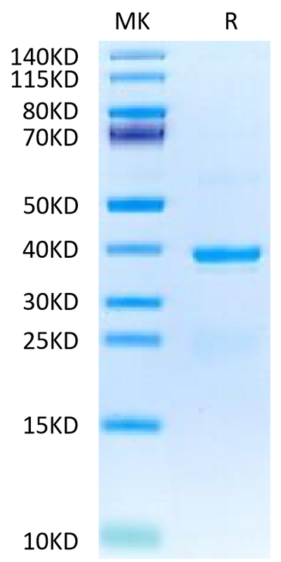 Human TSLP on Tris-Bis PAGE under reduced condition. The purity is greater than 95%.Recombinant Human TSLP Protein, Active