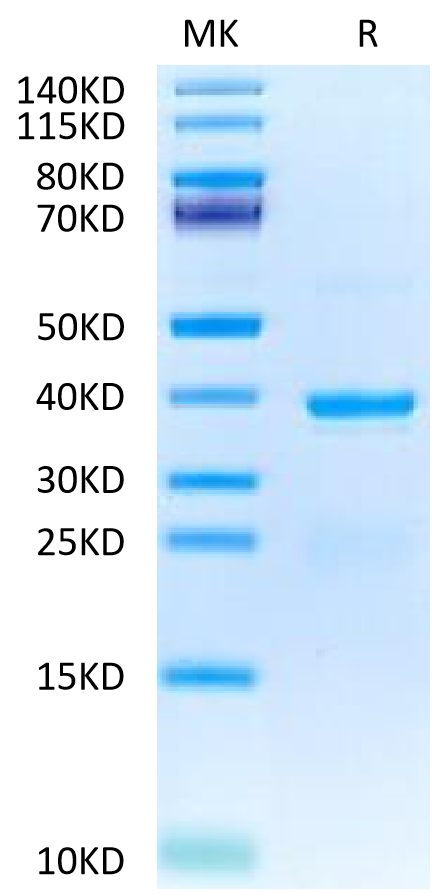 Human TSLP on Tris-Bis PAGE under reduced condition. The purity is greater than 95%.Recombinant Human TSLP Protein, Active