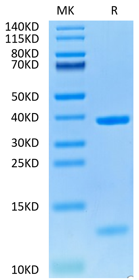 Human HLA-A*02:01&B2M&NY-ESO-1 (SLLMWITQC) Monomer on Tris-Bis PAGE under reduced condition. The purity is greater than 95%.Recombinant Human HLA-A*02:01&B2M&NY-ESO-1 (SLLMWITQC) Monomer Protein, Active