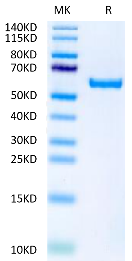Biotinylated Human APRIL Trimer on Tris-Bis PAGE under reduced condition. The purity is greater than 95%.Biotinylated Human APRIL/TNFSF13 Trimer Protein (Primary Amine Labeling), Active