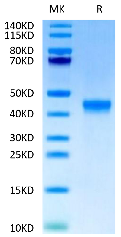 Cynomolgus FGL2 on Tris-Bis PAGE under reduced condition. The purity is greater than 95%.Recombinant Cynomolgus FGL2 Protein, Active