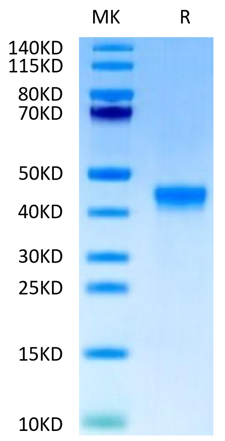 Cynomolgus FGL2 on Tris-Bis PAGE under reduced condition. The purity is greater than 95%.Recombinant Cynomolgus FGL2 Protein, Active