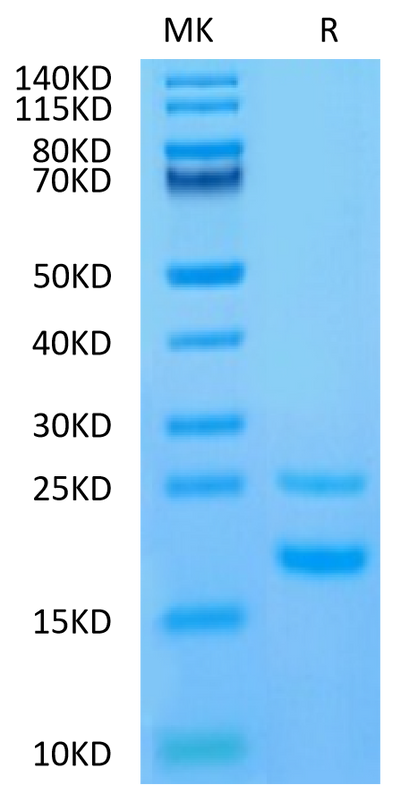 Human CCL5 on Tris-Bis PAGE under reduced condition. The purity is greater than 95%.Recombinant Human CCL5 Protein, Active