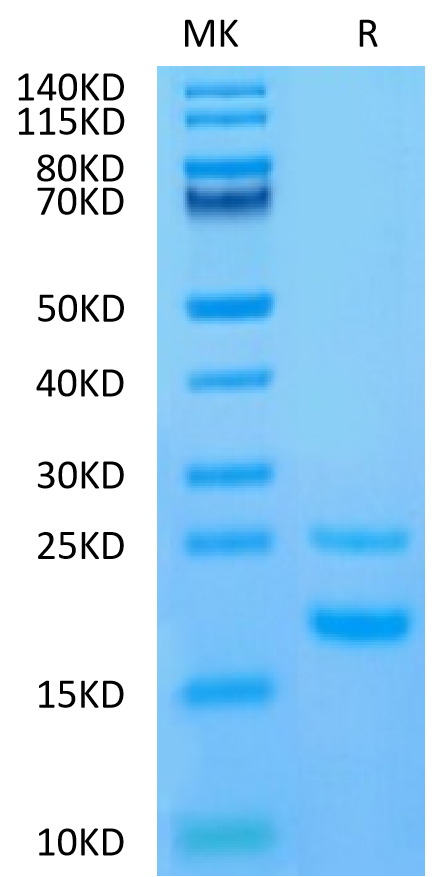 Human CCL5 on Tris-Bis PAGE under reduced condition. The purity is greater than 95%.Recombinant Human CCL5 Protein, Active